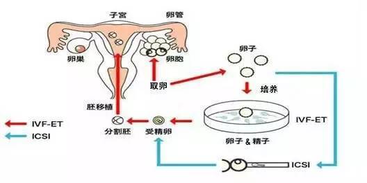 取卵后有忌口的东西